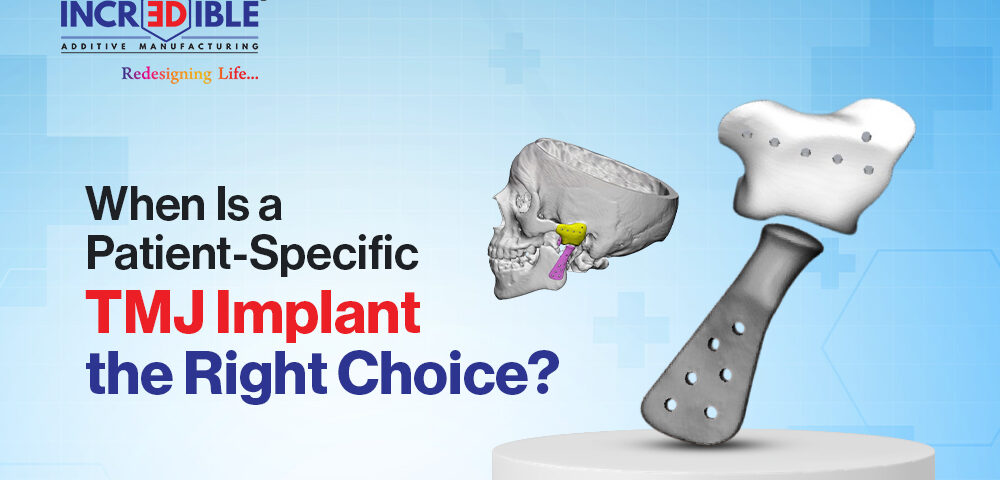 When Is a Patient-Specific TMJ Implant the Right Choice