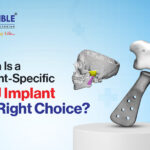 When Is a Patient-Specific TMJ Implant the Right Choice