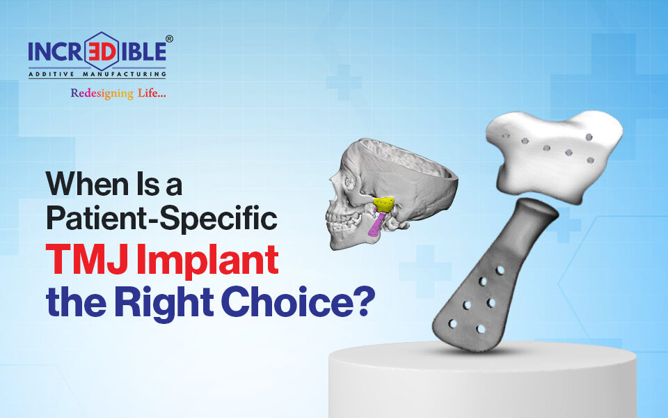 When Is a Patient-Specific TMJ Implant the Right Choice