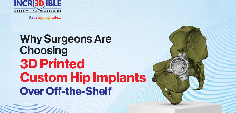 Why Surgeons Are Choosing 3D Printed Custom Hip Implants Over Off-the-Shelf