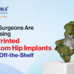 Why Surgeons Are Choosing 3D Printed Custom Hip Implants Over Off-the-Shelf