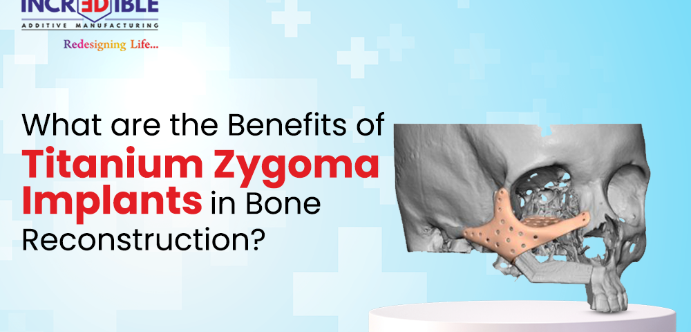 What are the Benefits of Titanium Zygoma Implants in Bone Reconstruction