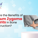 What are the Benefits of Titanium Zygoma Implants in Bone Reconstruction