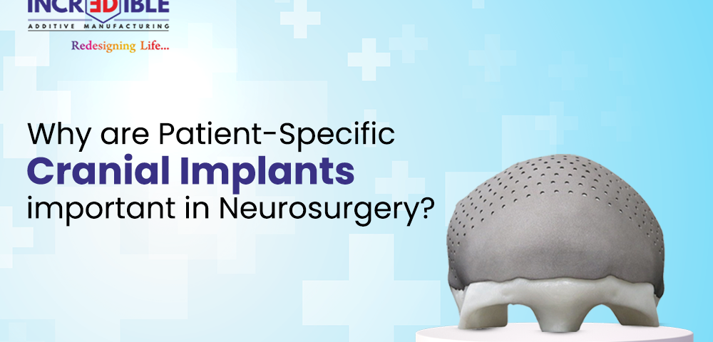 Why are Patient-Specific Cranial Implants Important in Neurosurgery