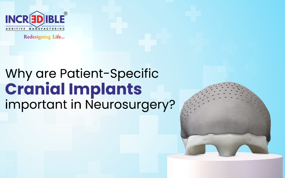 Why are Patient-Specific Cranial Implants Important in Neurosurgery