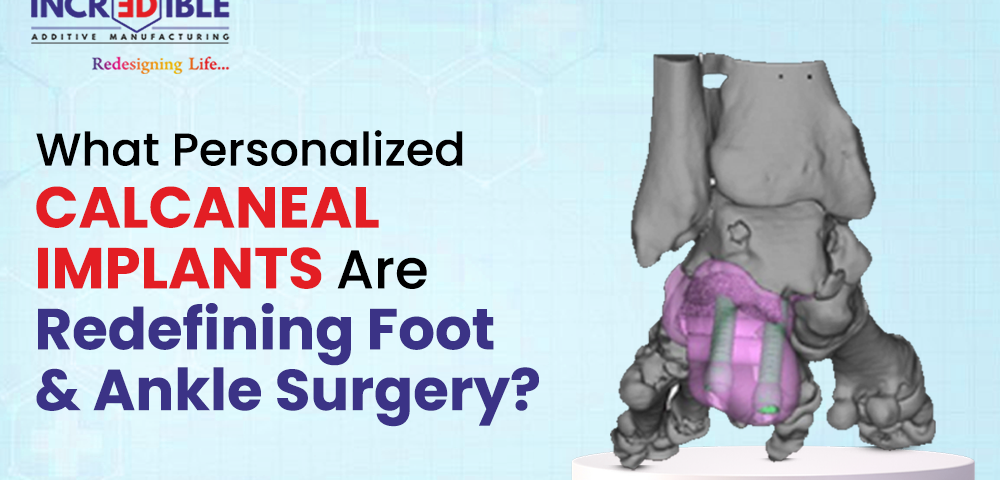 How Personalized Calcaneal Implants Are Redefining Foot and Ankle Surgery
