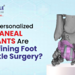 How Personalized Calcaneal Implants Are Redefining Foot and Ankle Surgery