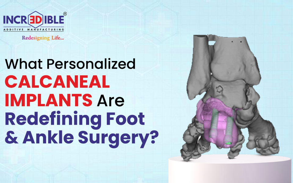 How Personalized Calcaneal Implants Are Redefining Foot and Ankle Surgery