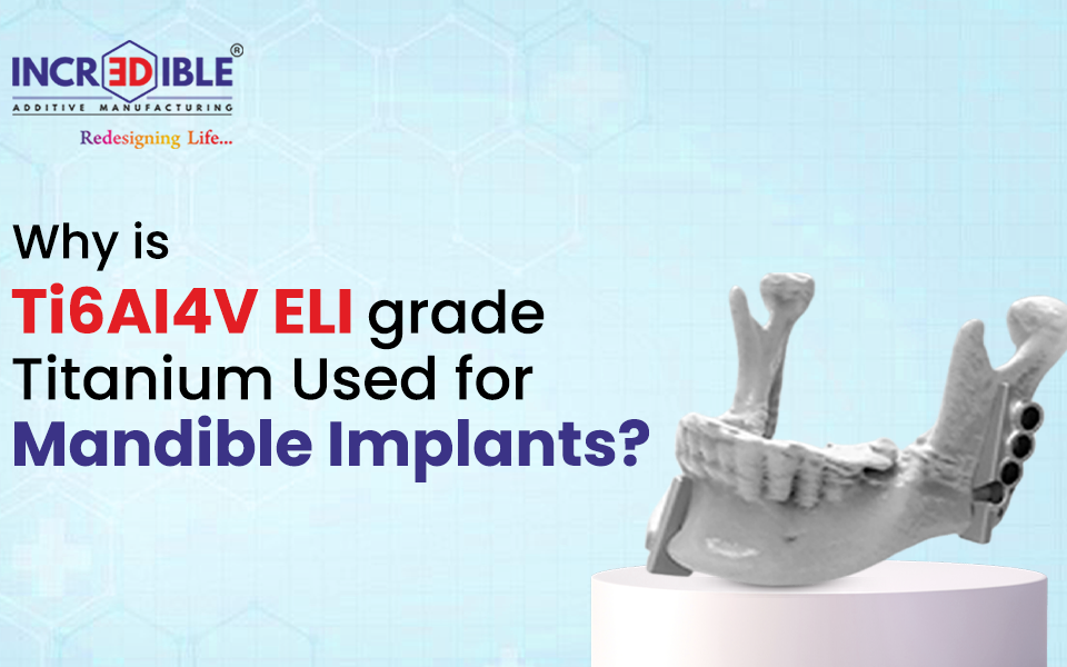 Why Is Ti6Al4V ELI Grade 23 Titanium Used for Mandible Implants