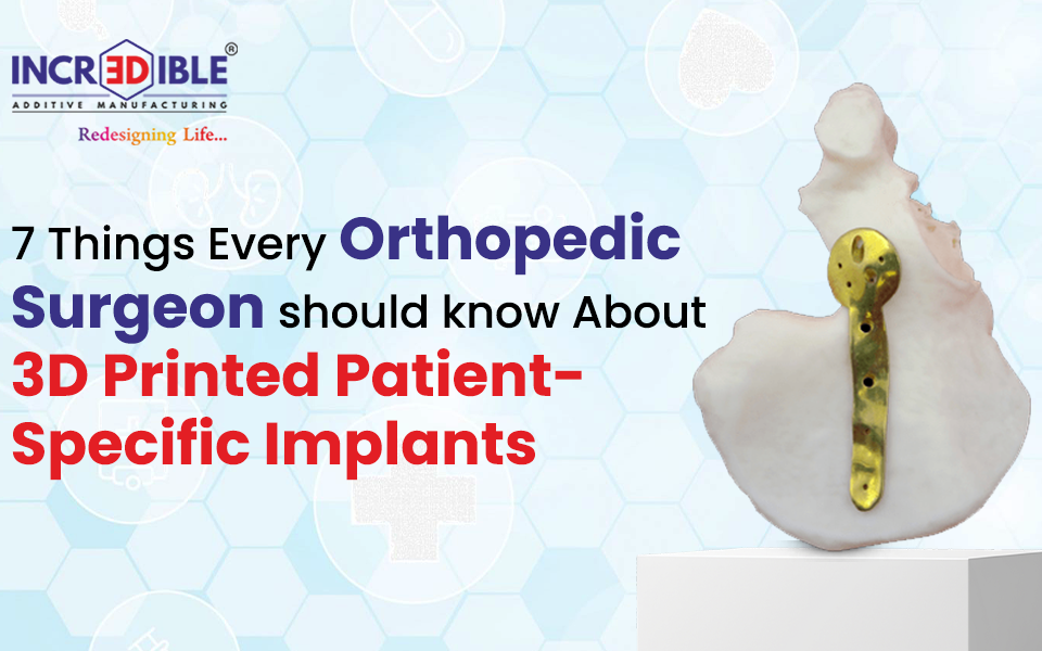 7 Things Every Orthopedic Surgeon Should Know About 3D Printed Patient-Specific Implants