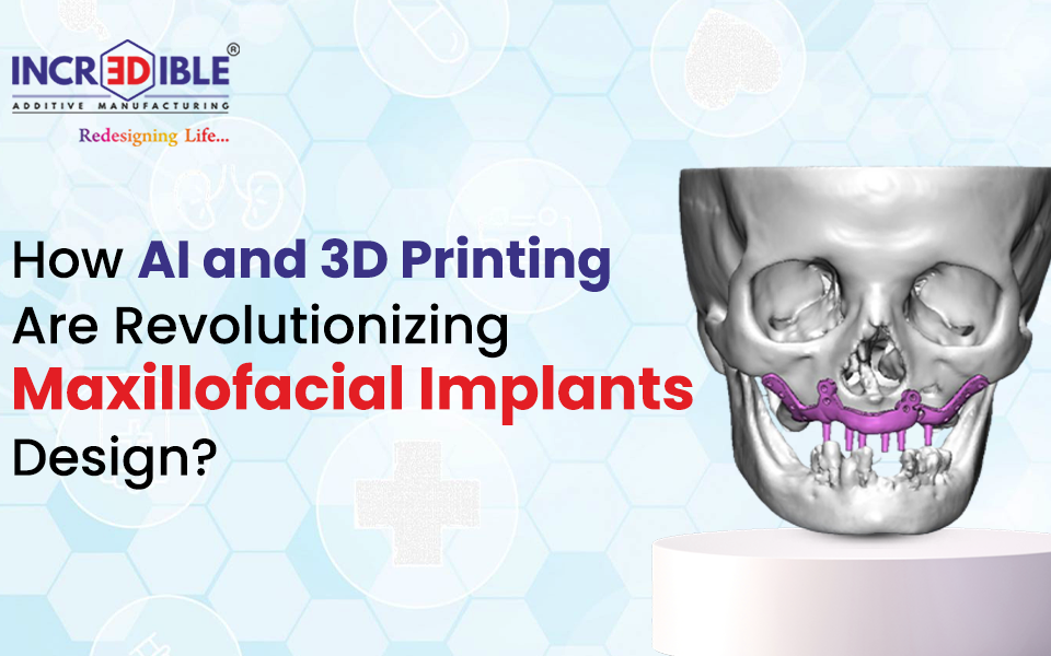 How AI and 3D Printing Are Revolutionizing Maxillofacial Implant Design