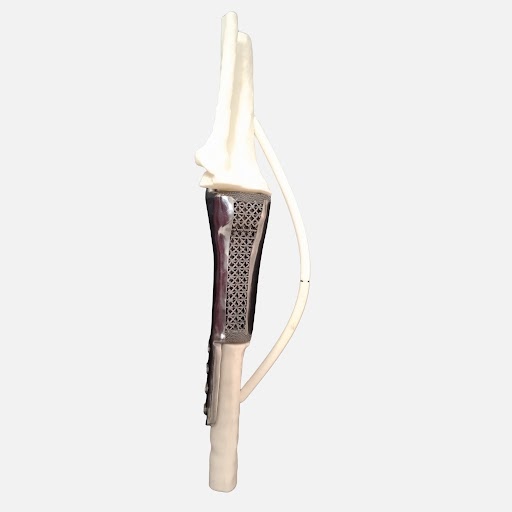 3D Printing Orthopaedic Implant