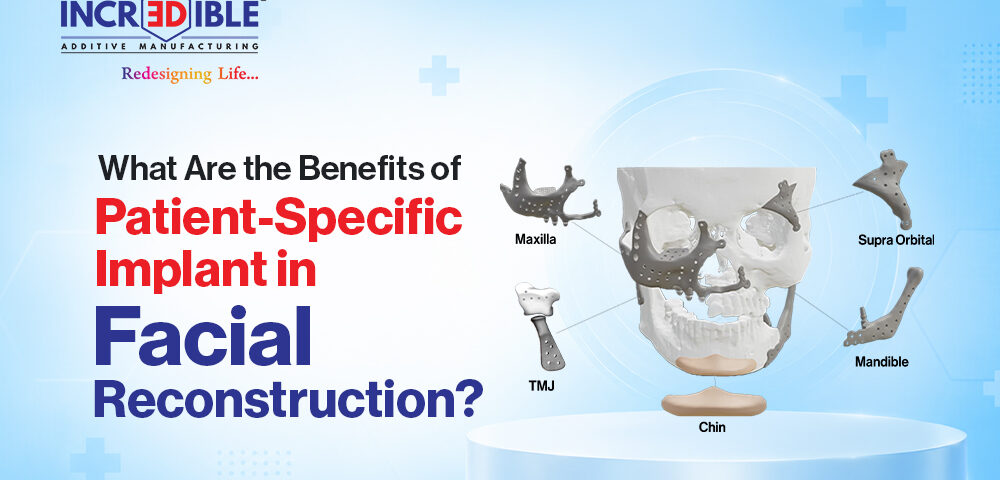 What Are the Benefits of Patient-Specific Implants in Facial Reconstruction