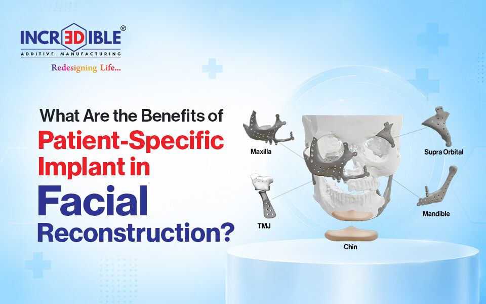 What Are the Benefits of Patient-Specific Implants in Facial Reconstruction