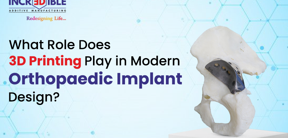 What Role Does 3D Printing Play in Modern Orthopaedic Implant Design