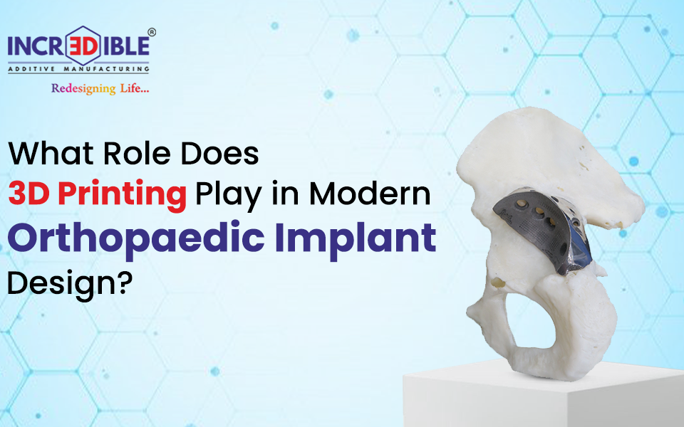 What Role Does 3D Printing Play in Modern Orthopaedic Implant Design