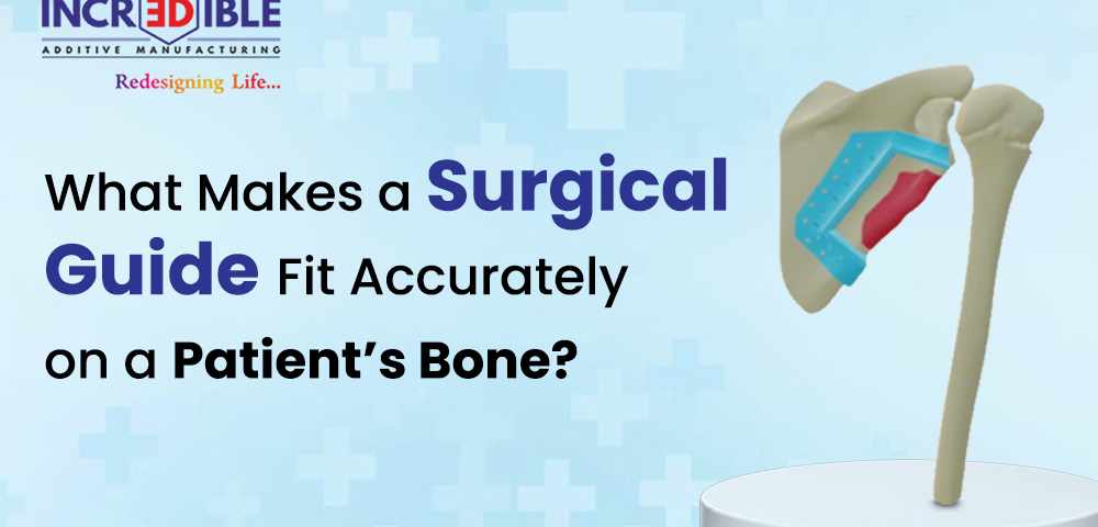 What Makes a Surgical Guide Fit Accurately on a Patient's Bone