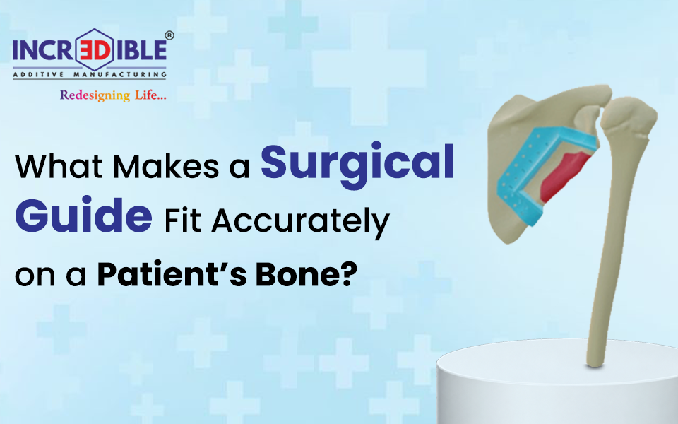 What Makes a Surgical Guide Fit Accurately on a Patient's Bone