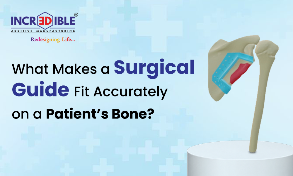 What Makes a Surgical Guide Fit Accurately on a Patient's Bone